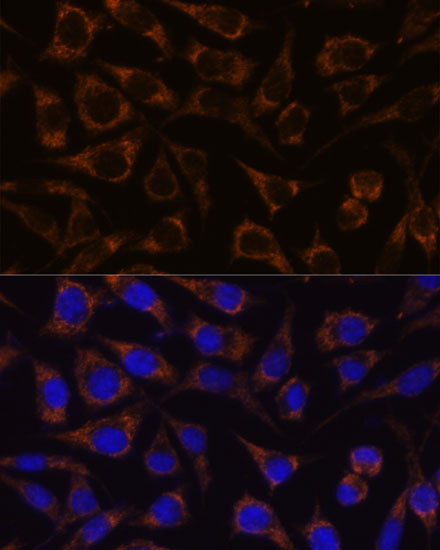 GTPBP8 Rabbit polyclonal antibody