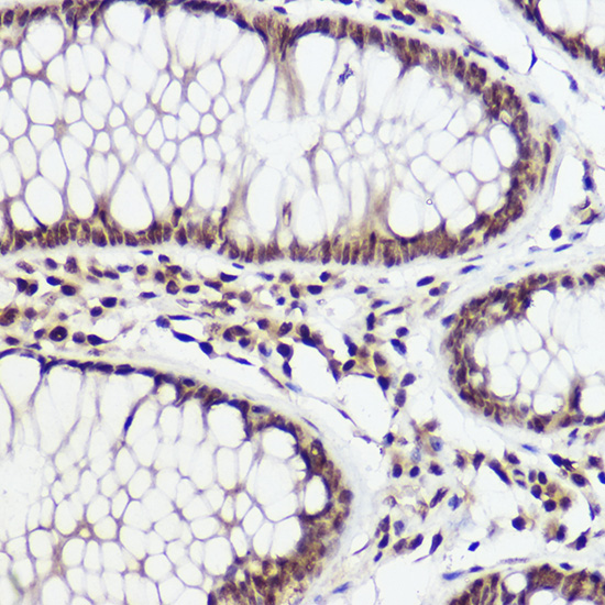 WBP11 Rabbit polyclonal antibody