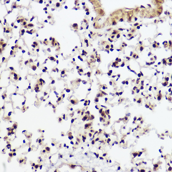 WBP11 Rabbit polyclonal antibody