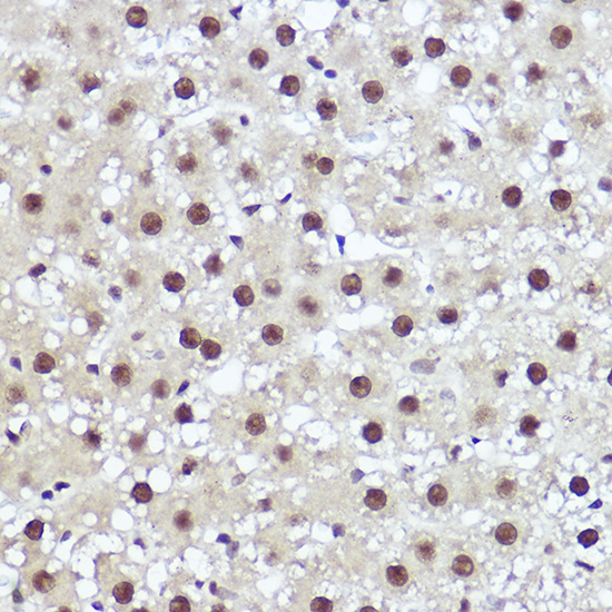 WBP11 Rabbit polyclonal antibody