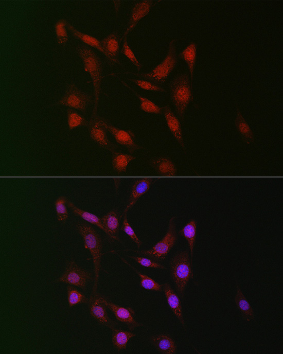 WBP11 Rabbit polyclonal antibody