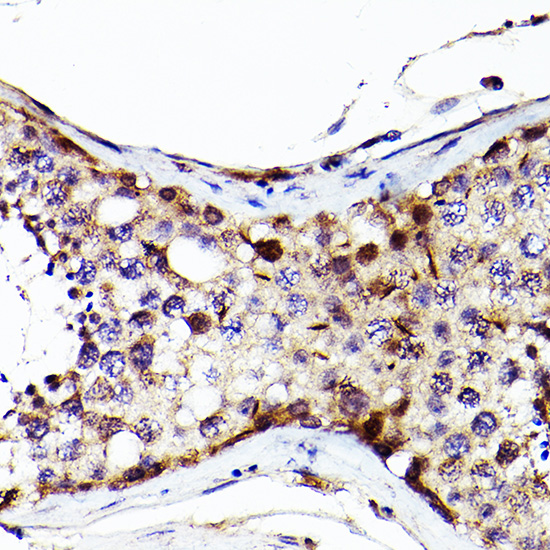 Sall4 Rabbit polyclonal antibody