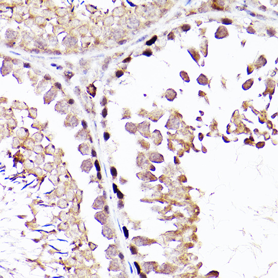 Sall4 Rabbit polyclonal antibody
