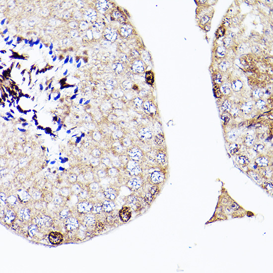 Sall4 Rabbit polyclonal antibody