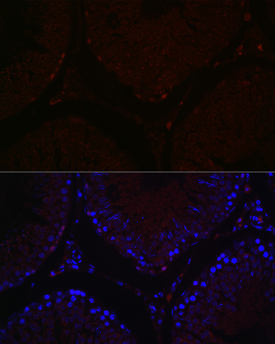 Sall4 Rabbit polyclonal antibody