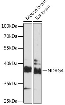 NDRG4 Rabbit polyclonal antibody