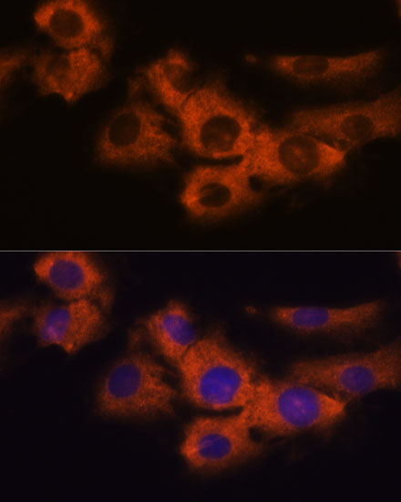 NDRG4 Rabbit polyclonal antibody