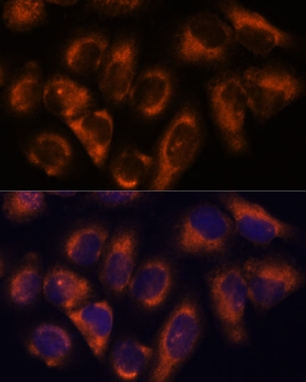 NDRG4 Rabbit polyclonal antibody