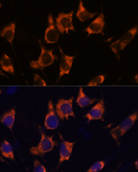 NDRG4 Rabbit polyclonal antibody