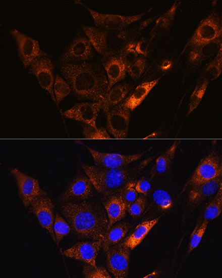 HCN1 Rabbit polyclonal antibody