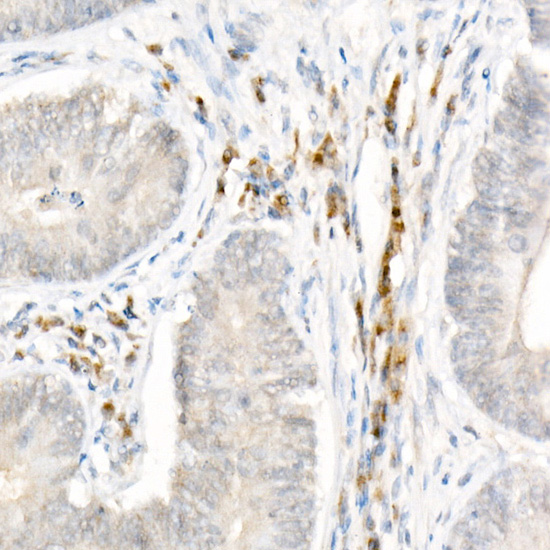 NLRP1 Rabbit polyclonal antibody