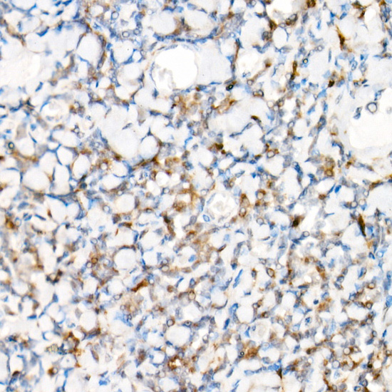 NLRP1 Rabbit polyclonal antibody