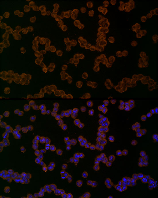 NLRP1 Rabbit polyclonal antibody