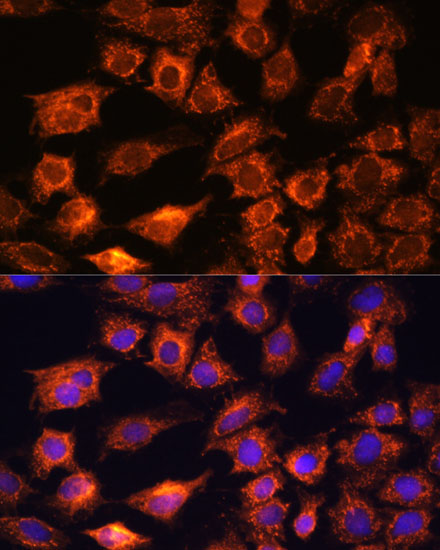 PTCD1 Rabbit polyclonal antibody