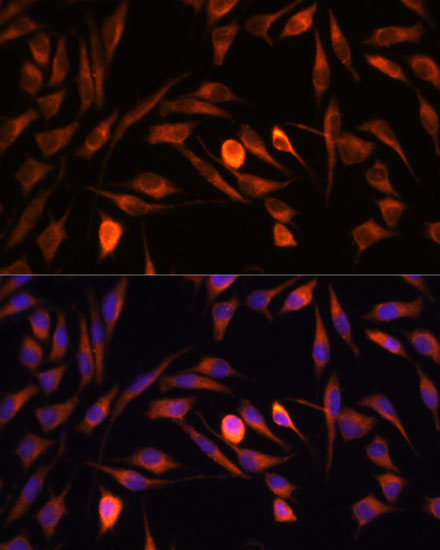 PTCD1 Rabbit polyclonal antibody