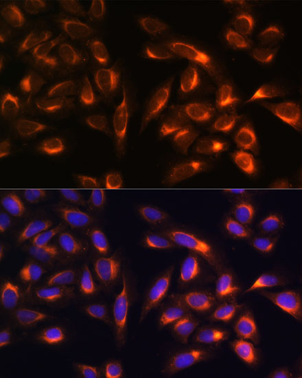 PTCD1 Rabbit polyclonal antibody