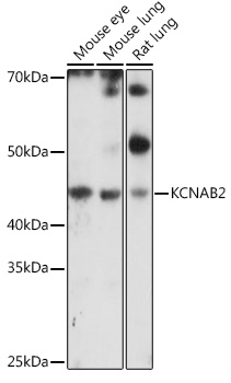 KCNAB2 Rabbit polyclonal antibody
