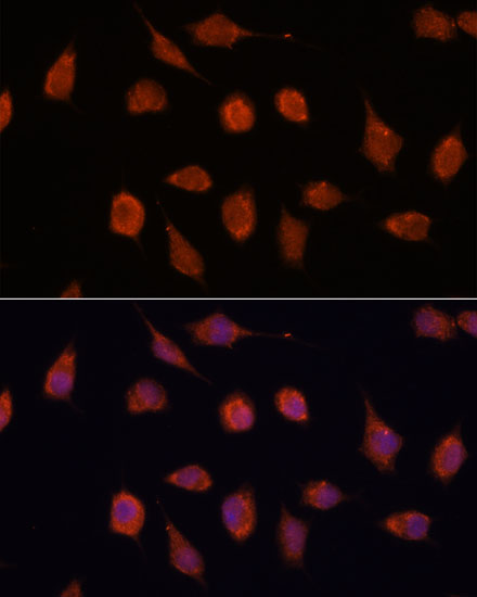 KCNAB2 Rabbit polyclonal antibody