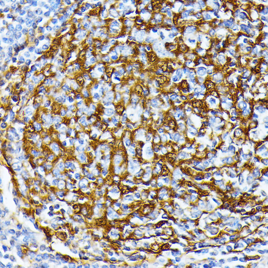 Casein Kinase 1 alpha (CSNK1A1) Rabbit polyclonal antibody