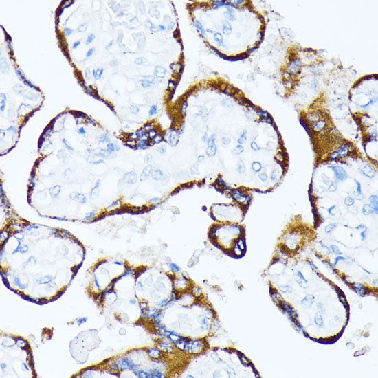 Casein Kinase 1 alpha (CSNK1A1) Rabbit polyclonal antibody