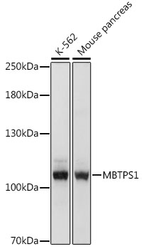 MBTPS1 Rabbit polyclonal antibody