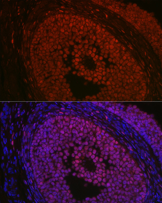 FOXL2 Rabbit polyclonal antibody
