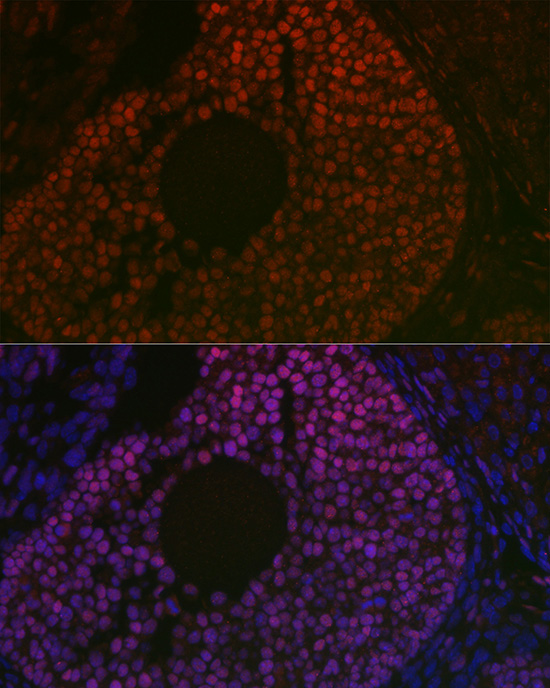 FOXL2 Rabbit polyclonal antibody