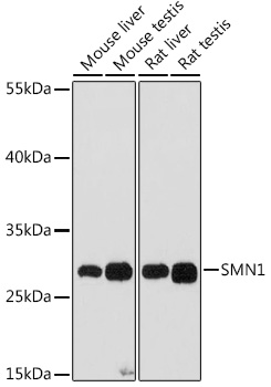 SMN1 Rabbit polyclonal antibody