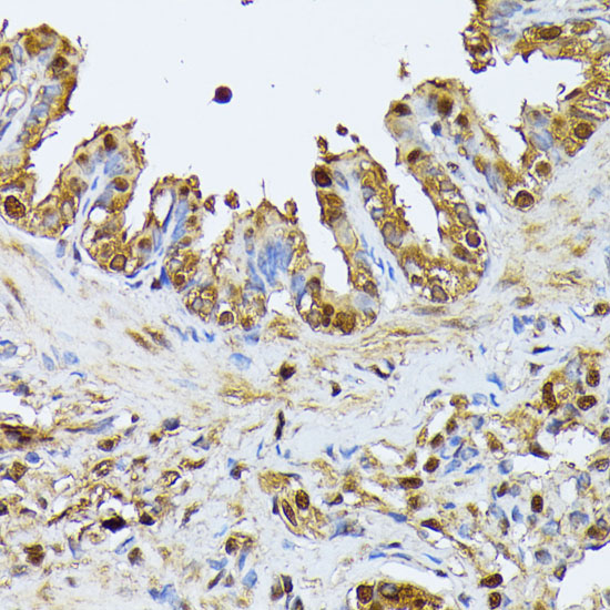 SMN1 Rabbit polyclonal antibody