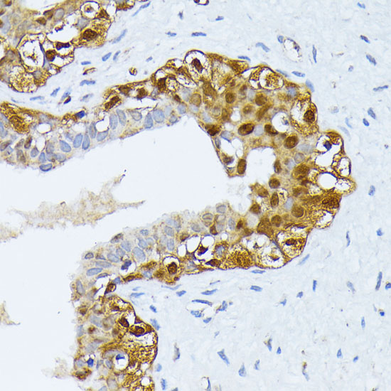 SMN1 Rabbit polyclonal antibody