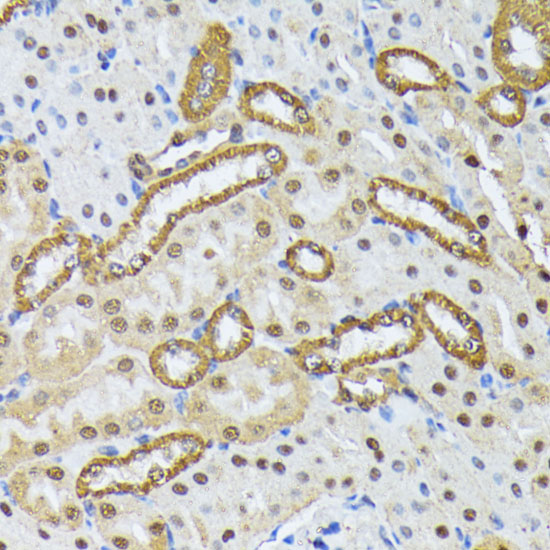 SMN1 Rabbit polyclonal antibody