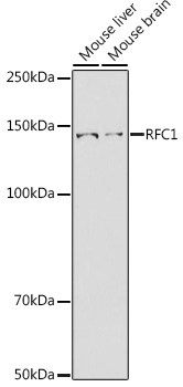 RFC1 Rabbit polyclonal antibody