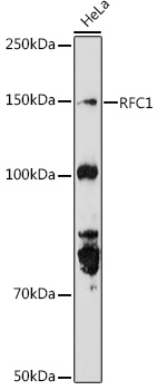 RFC1 Rabbit polyclonal antibody