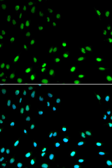 RFC1 Rabbit polyclonal antibody