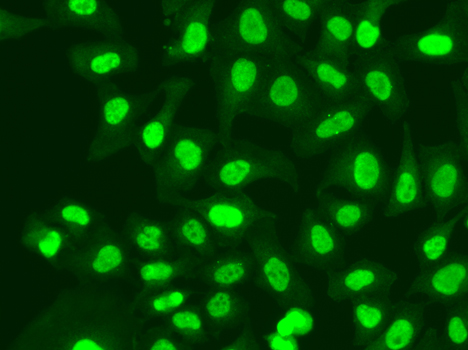 RFC1 Rabbit polyclonal antibody