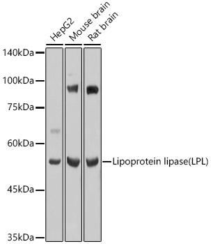 Lipoprotein lipase (LPL) Rabbit polyclonal antibody