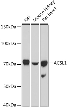 ACSL1 Rabbit polyclonal antibody