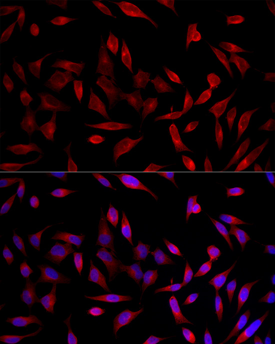 ACSL1 Rabbit polyclonal antibody