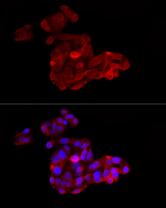 ACSL1 Rabbit polyclonal antibody