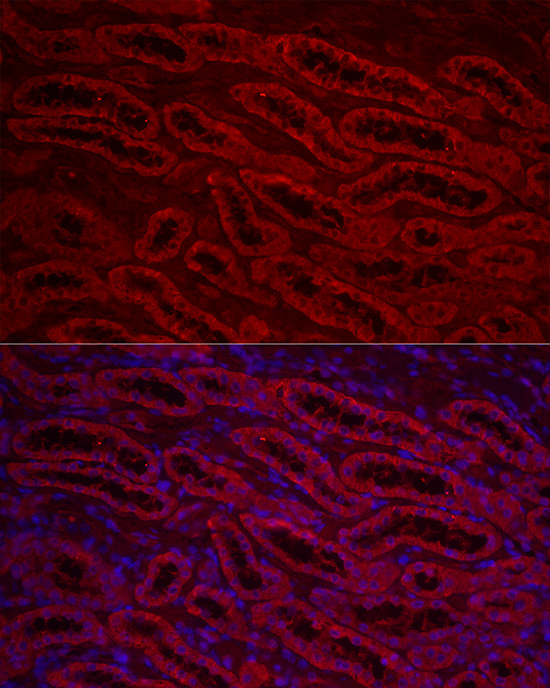 ACSL1 Rabbit polyclonal antibody