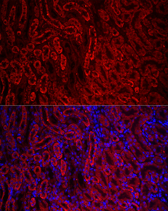ACSL1 Rabbit polyclonal antibody