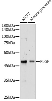 PLGF Rabbit polyclonal antibody