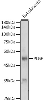 PLGF Rabbit polyclonal antibody