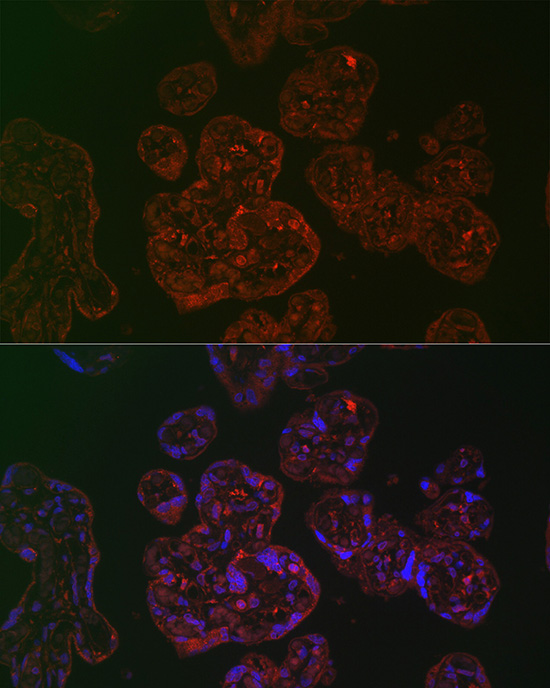 PLGF Rabbit polyclonal antibody