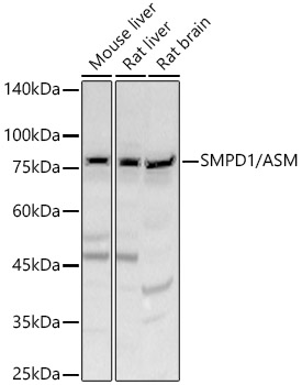 SMPD1 / ASM Rabbit polyclonal antibody