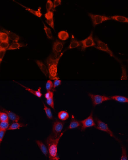 SMPD1 / ASM Rabbit polyclonal antibody