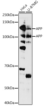 [KO Validated] APP Rabbit polyclonal antibody