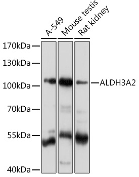 ALDH3A2 Rabbit polyclonal antibody