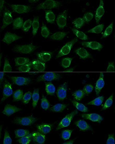 ALDH3A2 Rabbit polyclonal antibody