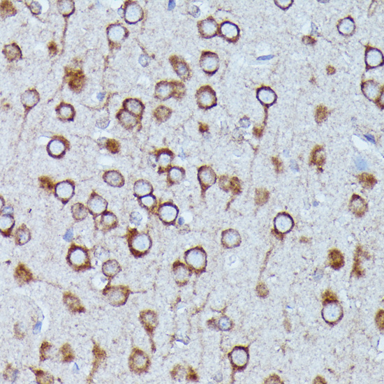 DDX6 Rabbit polyclonal antibody